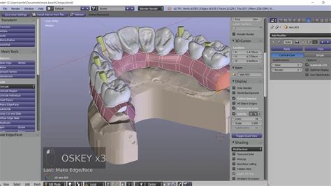 Este módulo de <b>Blender for Dental</b> permite crear encerados diagnosticos mediante librerías de dientes digitales. . Blender for dental crack